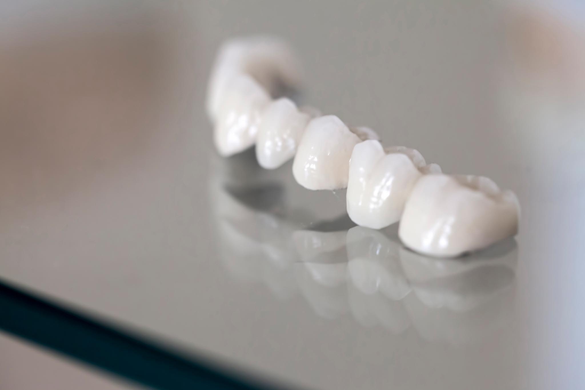 【全瓷冠案例】成功案例分享，高品質瓷牙打造微笑曲線！品森美學牙醫