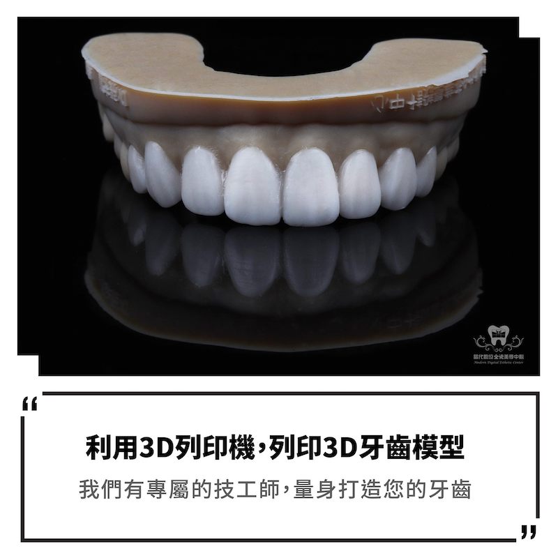 用3D列印機印出經微笑設計的牙齒模型