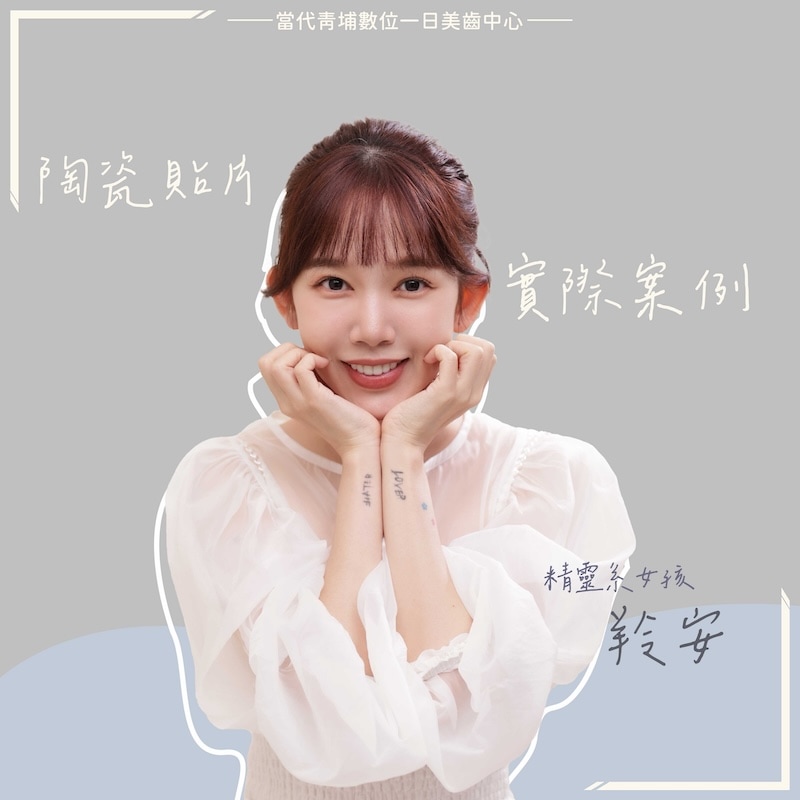 羚安完成陶瓷貼片療程後的美齒寫真，展現自然亮白的齒色與精緻微笑曲線