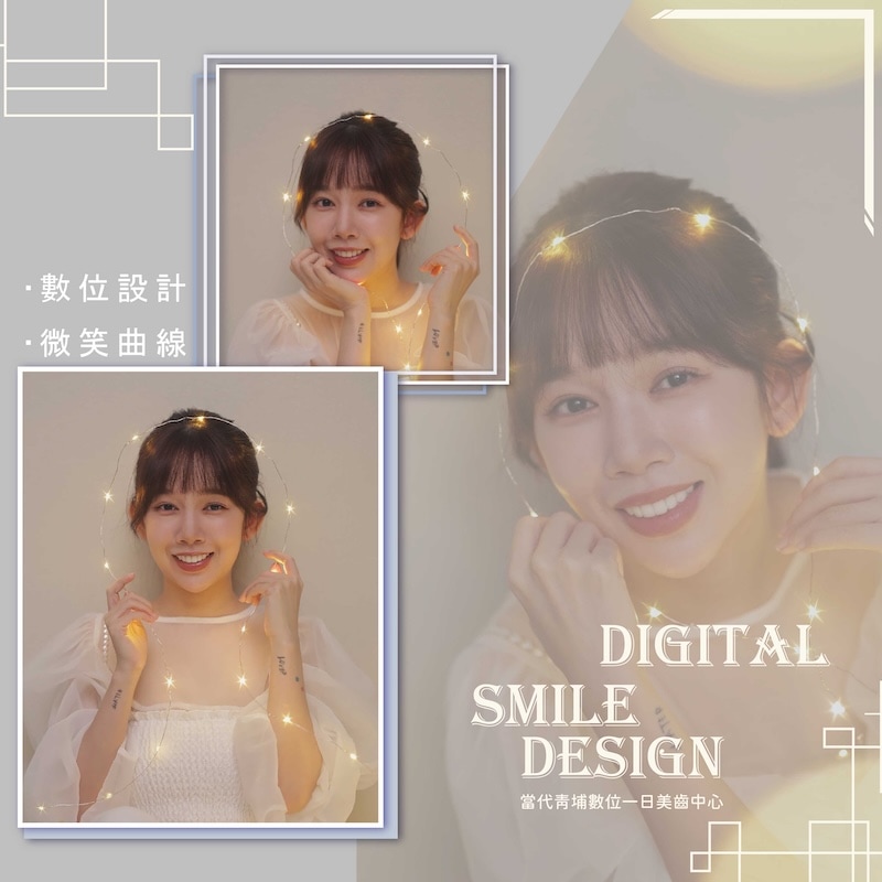 羚安完成陶瓷貼片療程後的美齒寫真，展現自然亮白的齒色與精緻微笑曲線