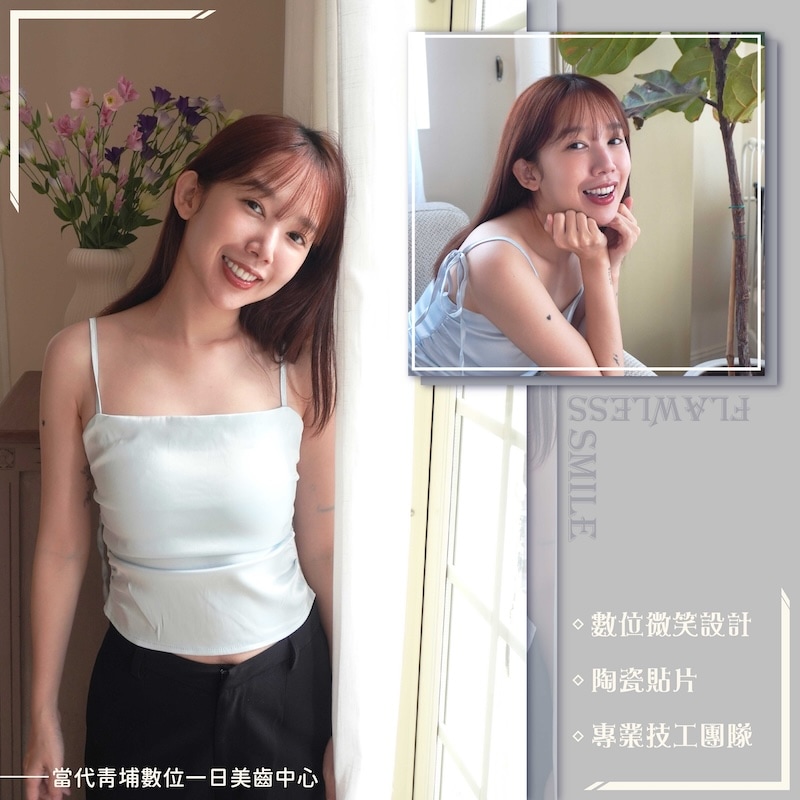 羚安完成陶瓷貼片療程後的美齒寫真，展現自然亮白的齒色與精緻微笑曲線