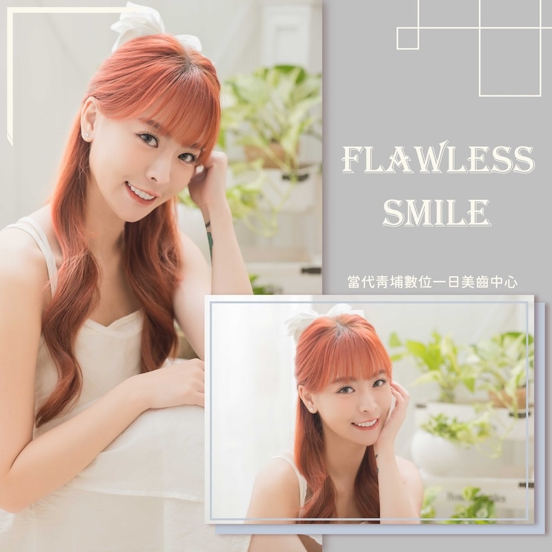 樂天女孩心韻陶瓷貼片療程後笑容自信自然，展現自然白皙齒色與完美微笑曲線