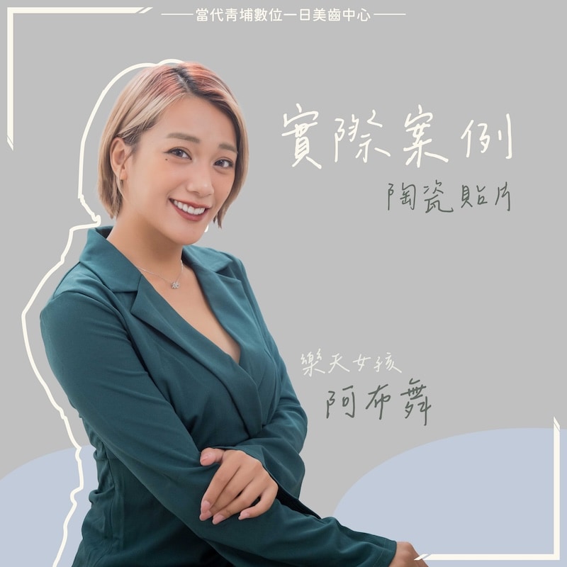 阿布舞完成陶瓷貼片與水雷射牙齦調整後,呈現自然亮白笑容