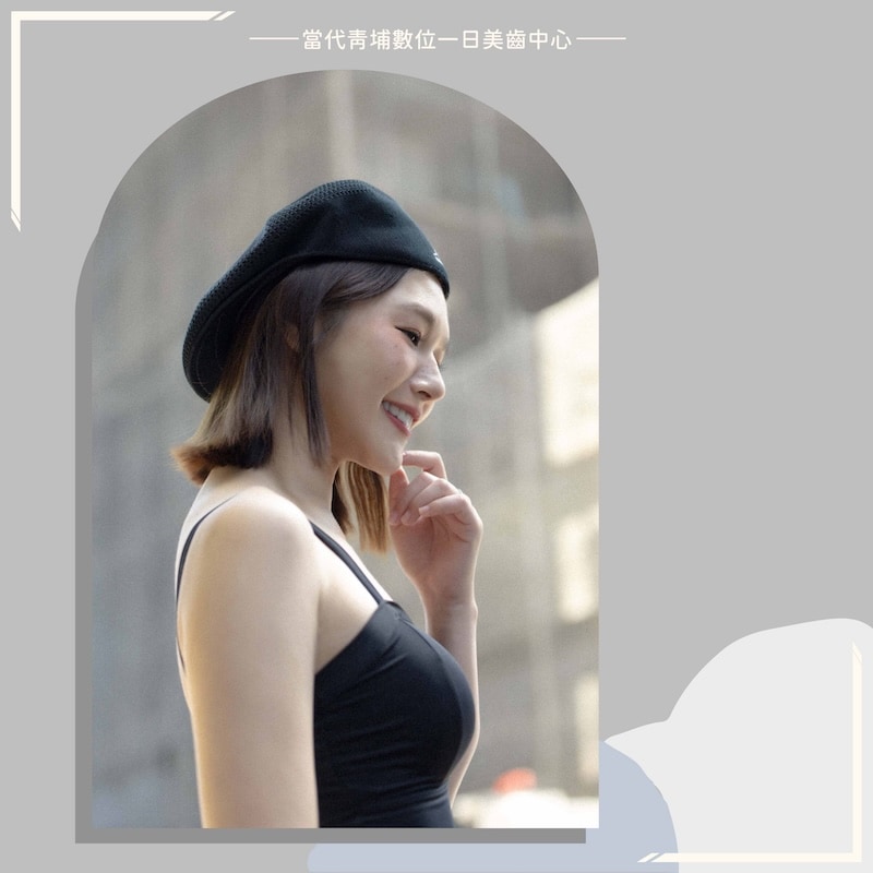 陶瓷貼片改善矯正後牙齒脫鈣變黃，啾啾妹露出自信笑容